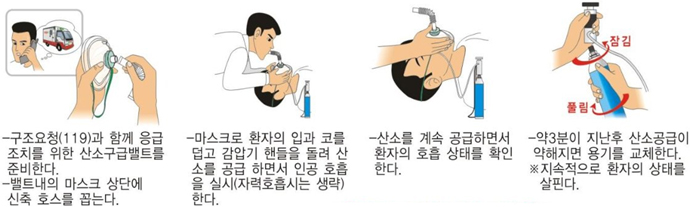응급구호용 산소공급기